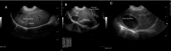 Evolução da imagem de vesícula biliar do paciente Border Collie. A: vesicula biliar sem tratamento (lama grau 4). B: vesicula biliar após início de medicações, sem troca de aliemntação (lama grau 3) . C: vesicula biliar com medicações e troca de aliemntação (lama grau 1). Fonte: arquivo pessoal