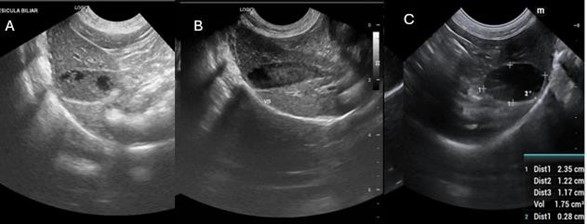 Imagem mostrando Evolução da imagem de vesícula biliar do paciente Chihuahua. A: vesicula biliar sem tratamento (lama grau 4). B: vesicula biliar após início de medicações, sem troca de aliimentação (lama grau 3) . C: vesicula biliar com medicações e após troca de alimentação (lama grau 1)